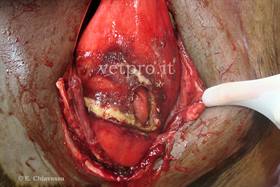 Left displacement of abomasum with perforated ulceration