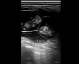 Diagnosi di gravidanza (gemelli 50 gg)