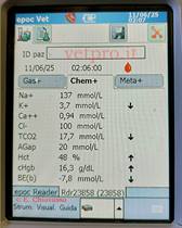 Caso clinico 13: una paresi anomala