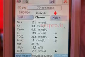 Paresi metabolica alla messa in asciutta