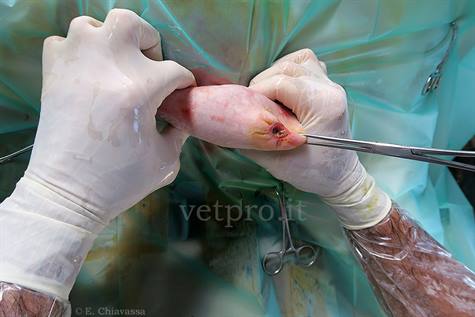 Intervento chirurgico per una onfaloflebite con ascesso intra-addominale 